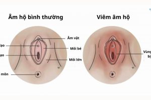 viem-am-dao-o-tre-em-1-300x200-1